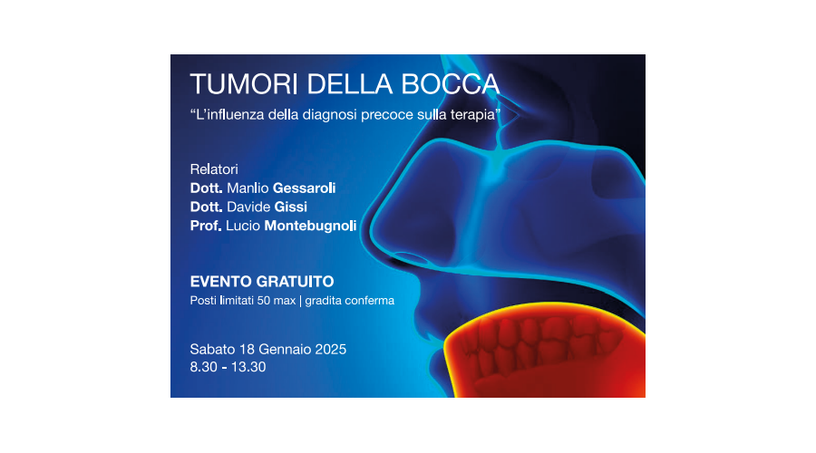 Clicca per accedere all'articolo Tumori della bocca: l'influenza della diagnosi precoce sulla terapia - 18 gennaio 2025